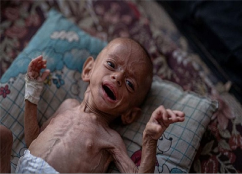 البرد القارس يقتل أطفال غزة حديثي الولادة وعدم توفر المستلزمات بالمستشفيات