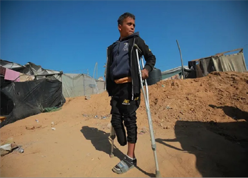 فيليب لازاريني: 10 أطفال يفقدون ساقاً أو ساقين في غزة يومياً
